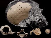 Medical 3D Printing Applications