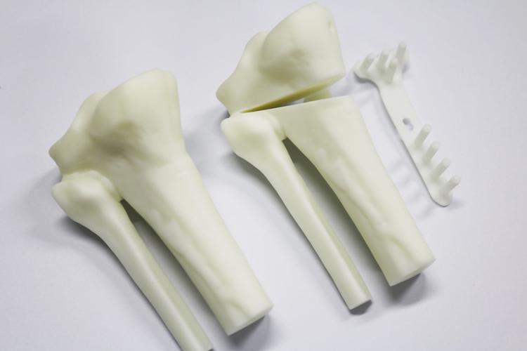 Medical device prototype 3D printed in resin