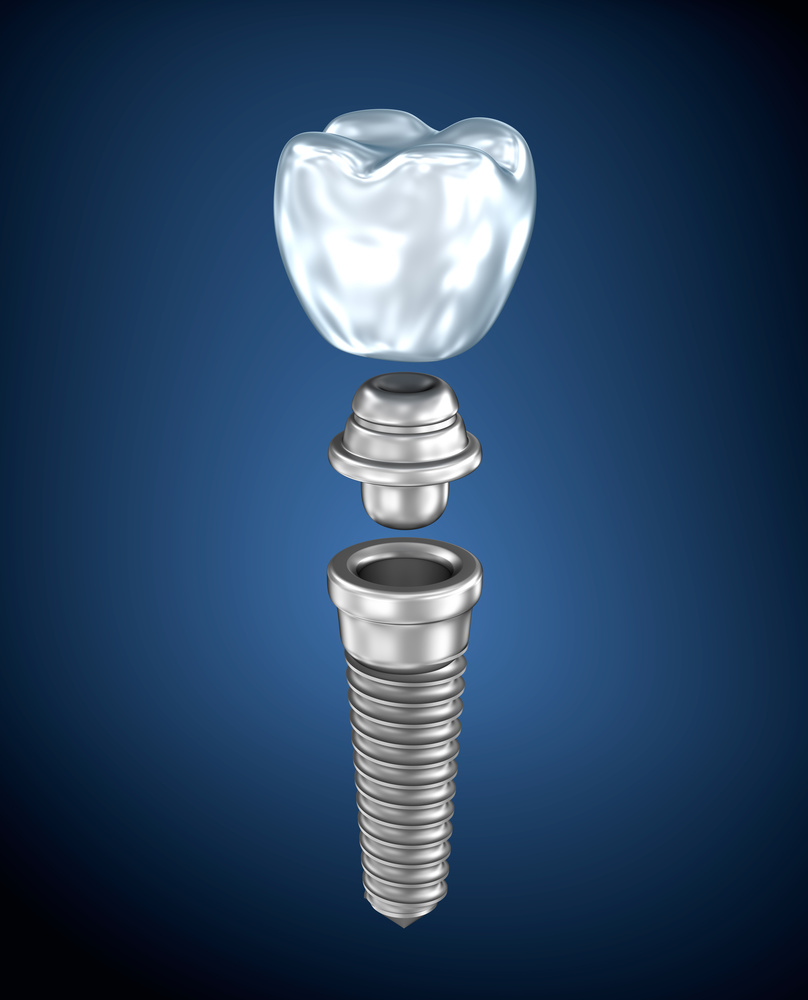 Medical Titanium Implant