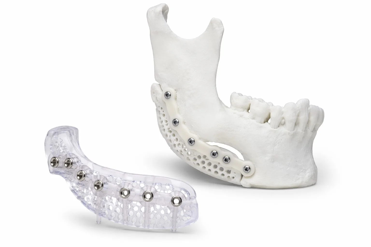 3D printed surgical guides and anatomical models